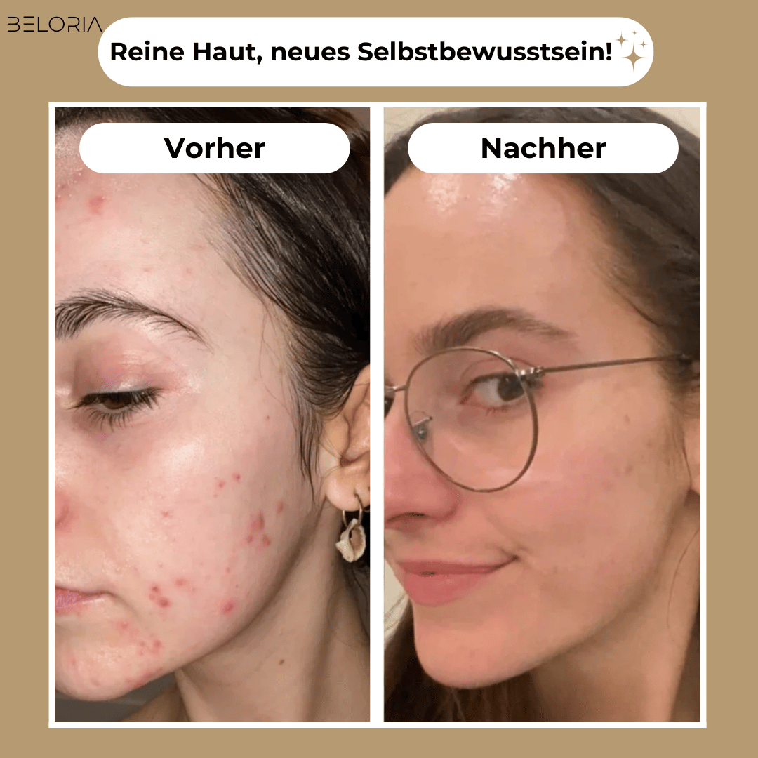 BELORIA SKIN LUXE – Der Boost für deine Haut