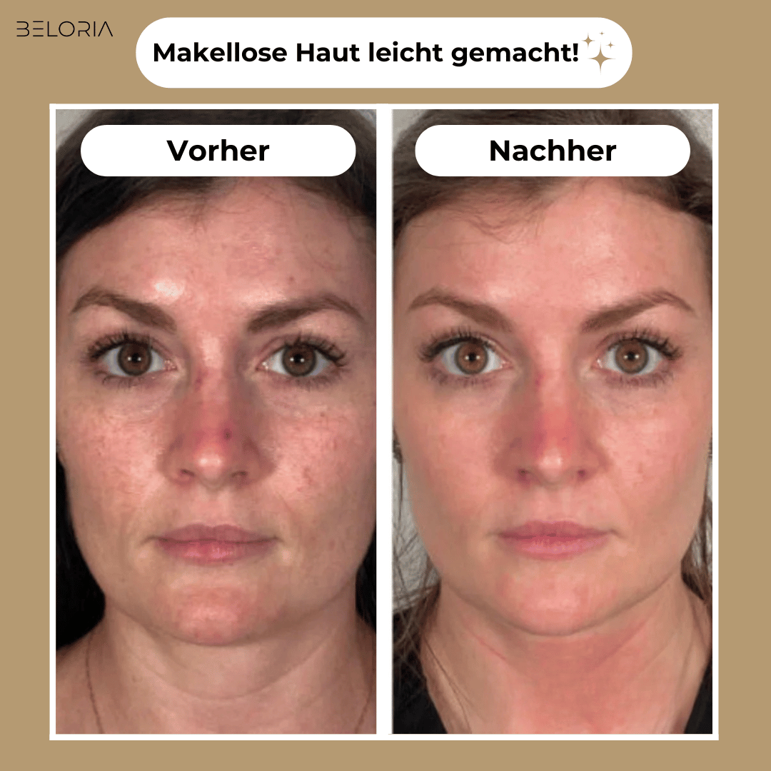 BELORIA SKIN LUXE – Der Boost für deine Haut