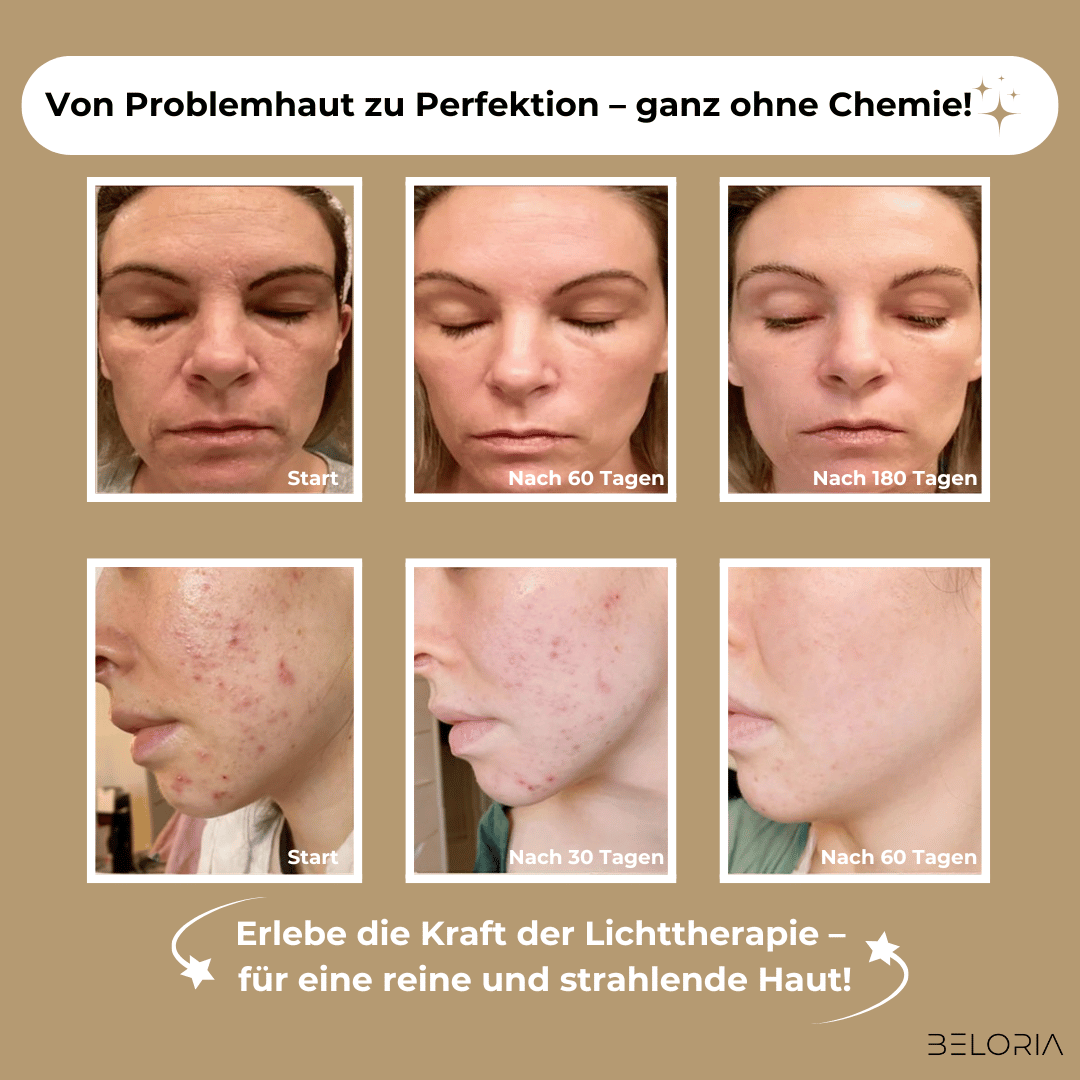 BELORIA SKIN LUXE – Der Boost für deine Haut